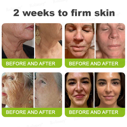 🧑‍⚕️ Rolimey® Botox-Like Peptides + Vita-A Retinol Shot – Wrinkle-Lift Tightening Cream - Last Day Promotion 50% OFF