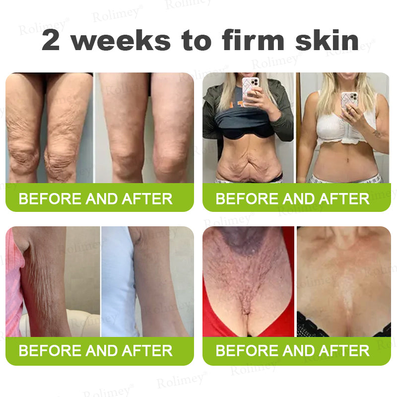 🧑‍⚕️ Rolimey® Botox-Like Peptides + Vita-A Retinol Shot – Wrinkle-Lift Tightening Cream - Last Day Promotion 50% OFF