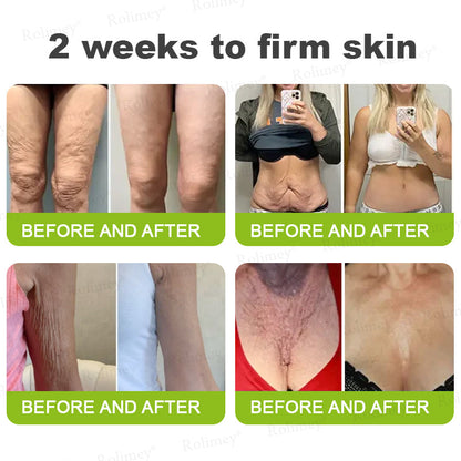 🧑‍⚕️ Rolimey® Botox-Like Peptides + Vita-A Retinol Shot – Wrinkle-Lift Tightening Cream - Last Day Promotion 50% OFF