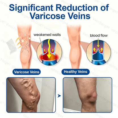 🧙GFOUK® VeinTarget Microneedle Patch⚡Instant Relief, Long-Term Results