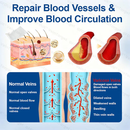 🧙GFOUK® VeinTarget Microneedle Patch⚡Instant Relief, Long-Term Results