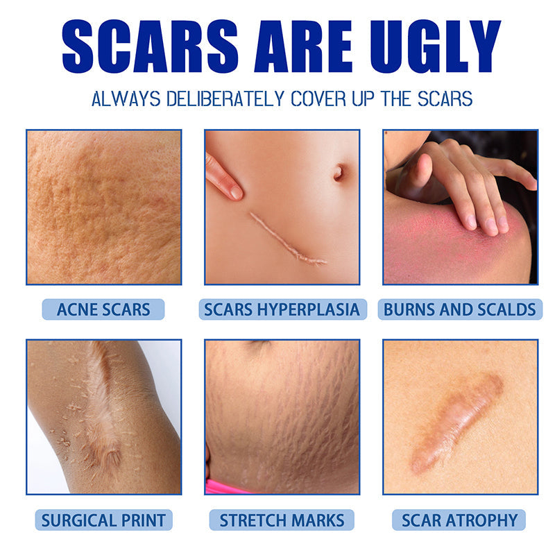 ⏰Final 3 Hours: 70%OFF🔥 GFOUK® Scar Repair Cream for Men and Women, fade scars and tighten skin in one step