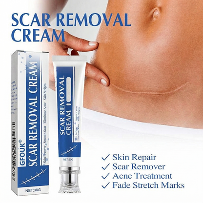 ⏰Final 3 Hours: 70%OFF🔥 GFOUK® Scar Repair Cream for Men and Women, fade scars and tighten skin in one step