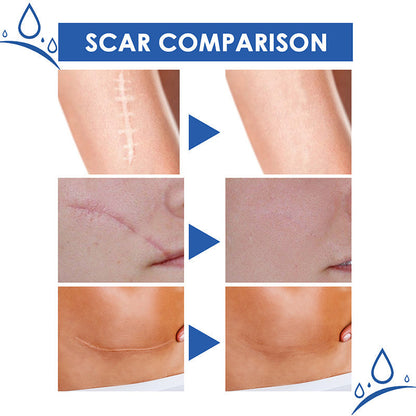 ⏰Final 3 Hours: 70%OFF🔥 GFOUK® Scar Repair Cream for Men and Women, fade scars and tighten skin in one step